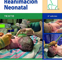 Reanimacion Neonatal